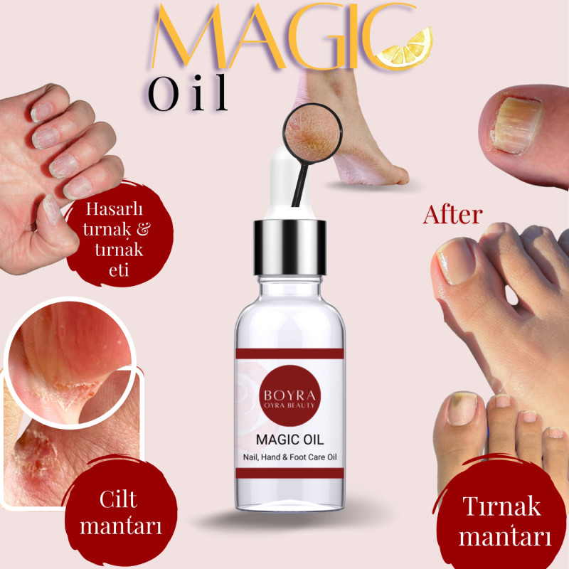 Magic Oil tırnak ve parmak arası mantarı